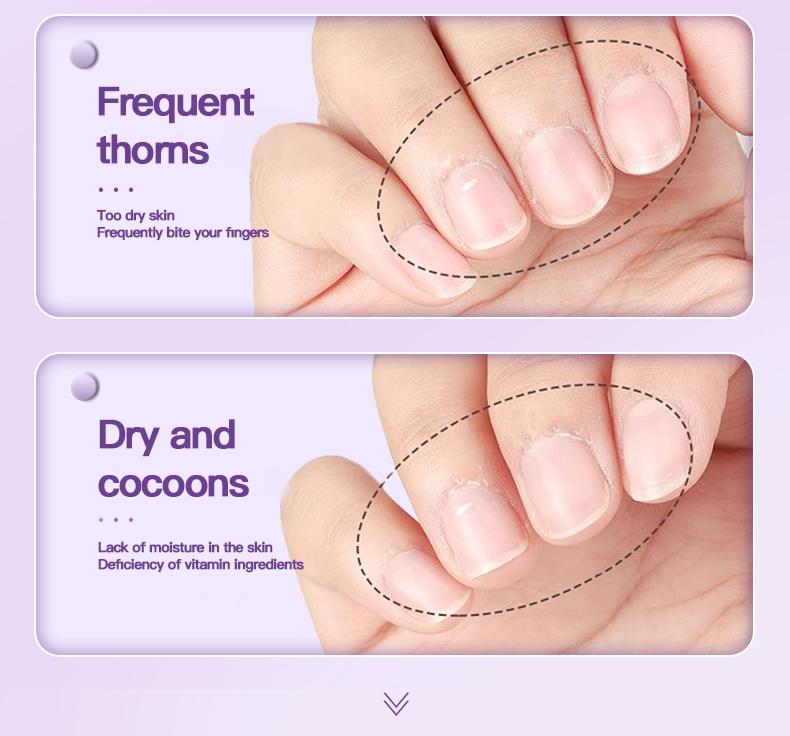 💅3-in-1 Nail Care Serum Oil Pen – Cuticle Remover, Nail Polish Remover & Nail Oil Treatment