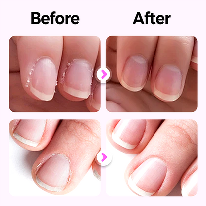 ✨3-in-1 Nail Care Pen for Home & Travel